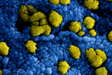 Virus